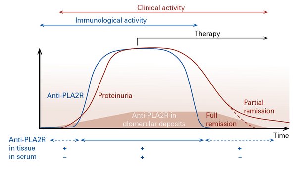 Modified illustration from: Francis et al., Am J Kidney Dis 68, 138-47 (2016)