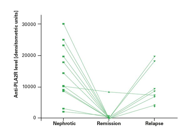 Modified illustration from: Hofstra et al., CJASN 6, 1-5 (2011)