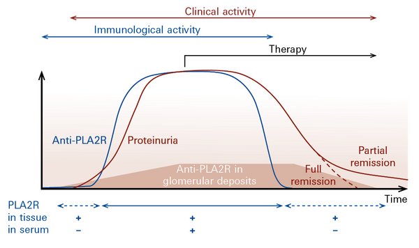 Modified illustration from: Francis et al., Am J Kidney Dis 68, 138-47 (2016)
