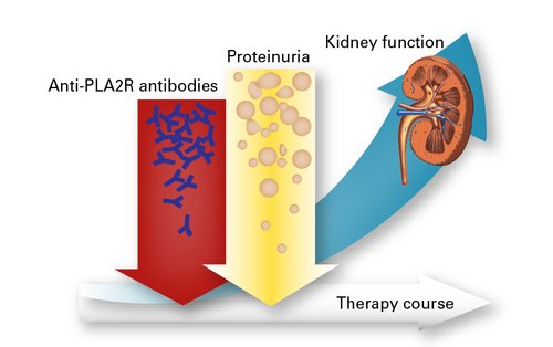 Relationship between anti-PLA2R antibodies, proteinuria, and renal function during the course of therapy