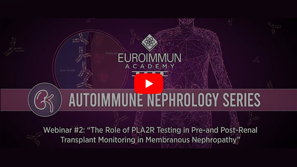 Autoimmune nephrology webinar series episode 2