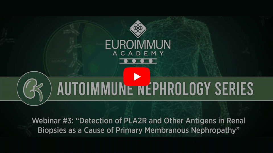 Autoimmune nephrology webinar series episode 3